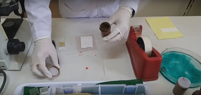 Examination of feces using the Fulleborn method